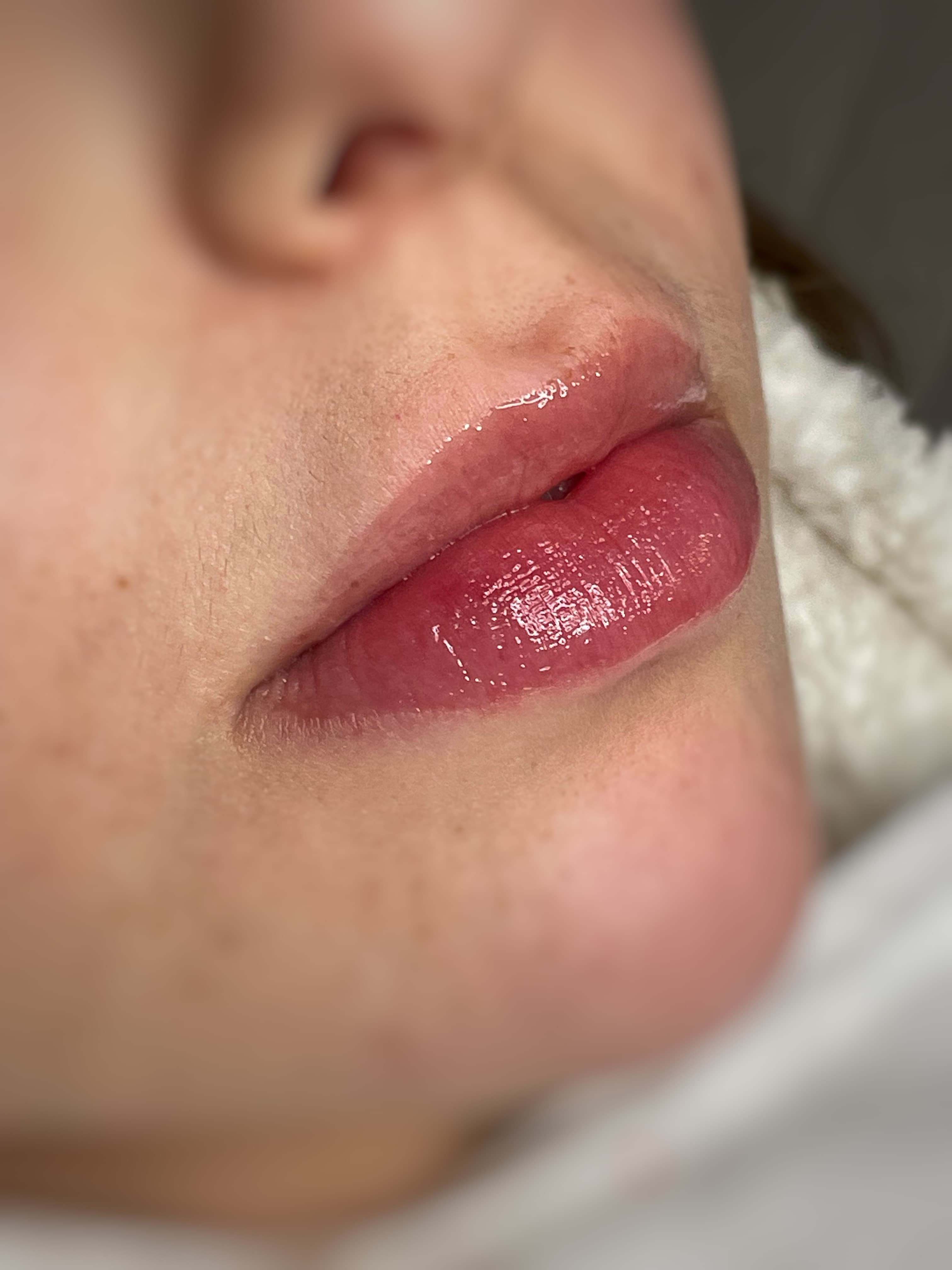 Spa Labial — resultado